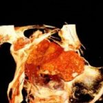 Read more about the article اكتشاف أول مومياء مصرية حامل