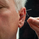 Read more about the article نظريات التأثير العلاجي للحجامة والإستفادة من الإبر الصينية – الحلقة 18
