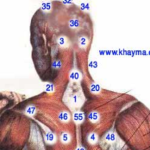 Read more about the article أمراض الجسم القابلة للتداوي بالحجامة والطب النبوي – الحلقة السادسة عشر
